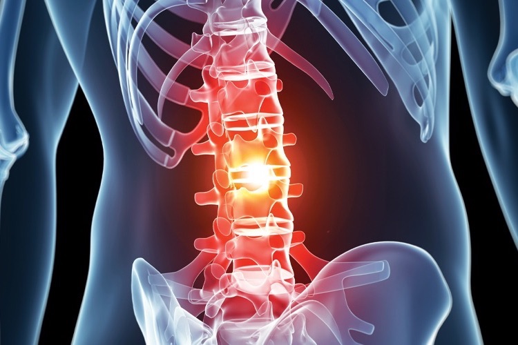 Degenerative Disc Disease explained