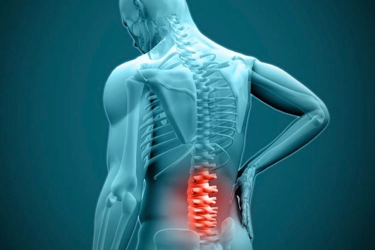 herniated disc treatment