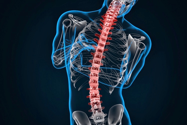what is spinal stenosis